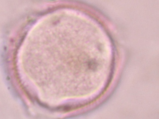 lyc ten 4